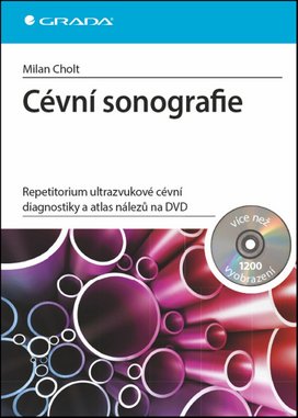 Cévní sonografie