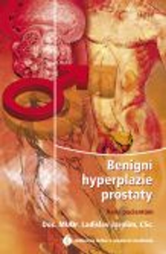 Benigní hyperplazie prostaty - rady pacientům
