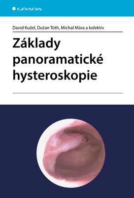 Základy panoramatické hysteroskopie
