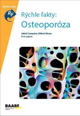 Rýchle fakty: Osteoporóza