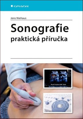 Sonografie Praktická příručka