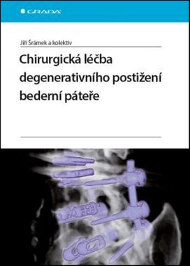 Chirurgická léčba degenerativního postižení bederní páteře