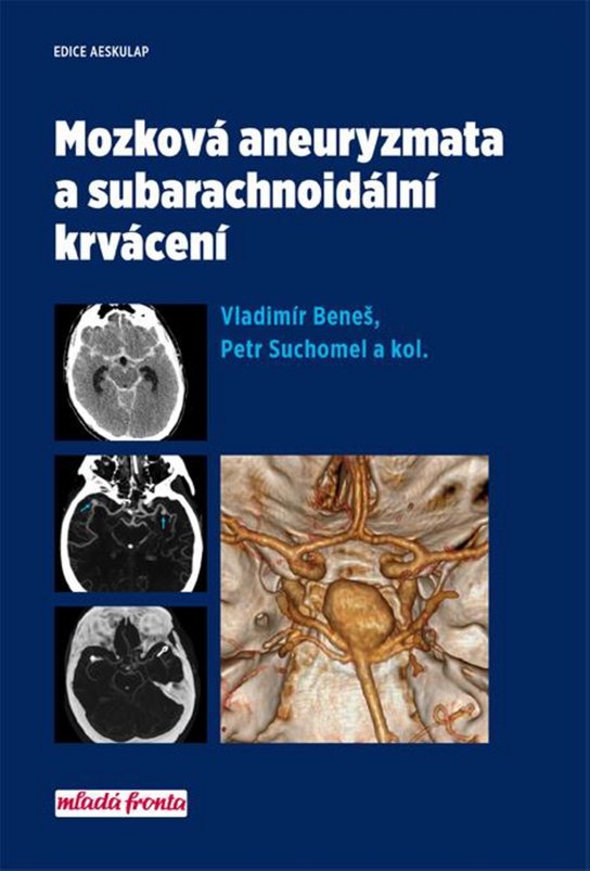 Mozková aneurysmata a subarachnoidální krvácení