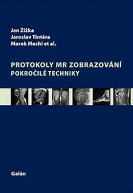 Protokoly v MR zobrazování