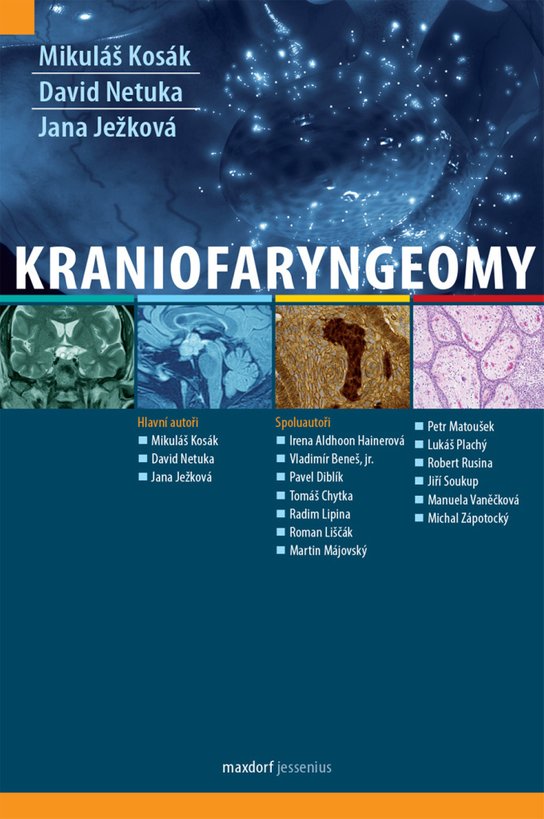 Kraniofaryngeomy