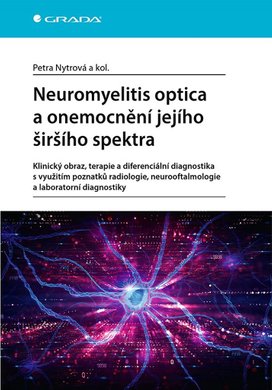 Neuromyelitis optica a poruchy jejího šišího spektra
