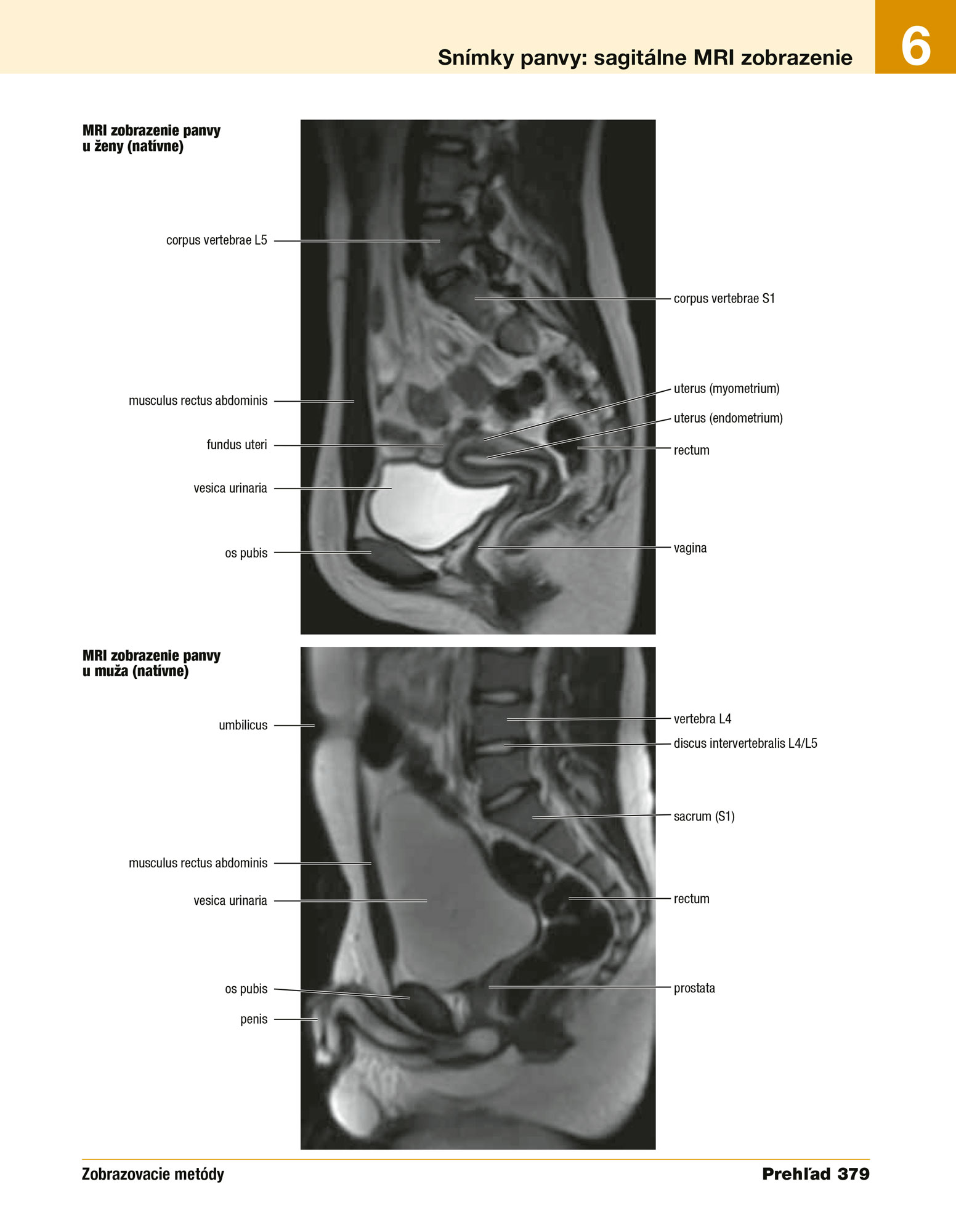 Netterov anatomický atlas človeka