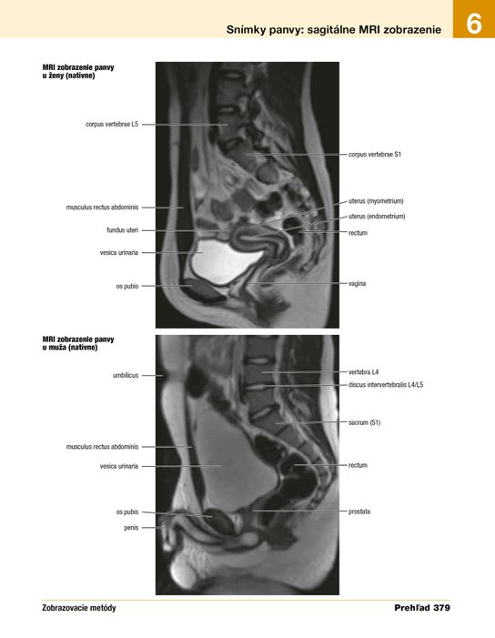 Netterov anatomický atlas človeka