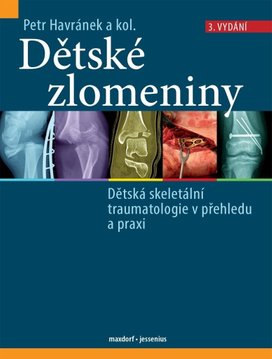 Dětské zlomeniny