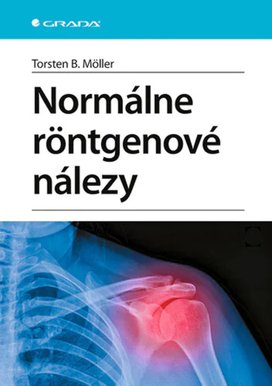 Normálne röntgenové nálezy